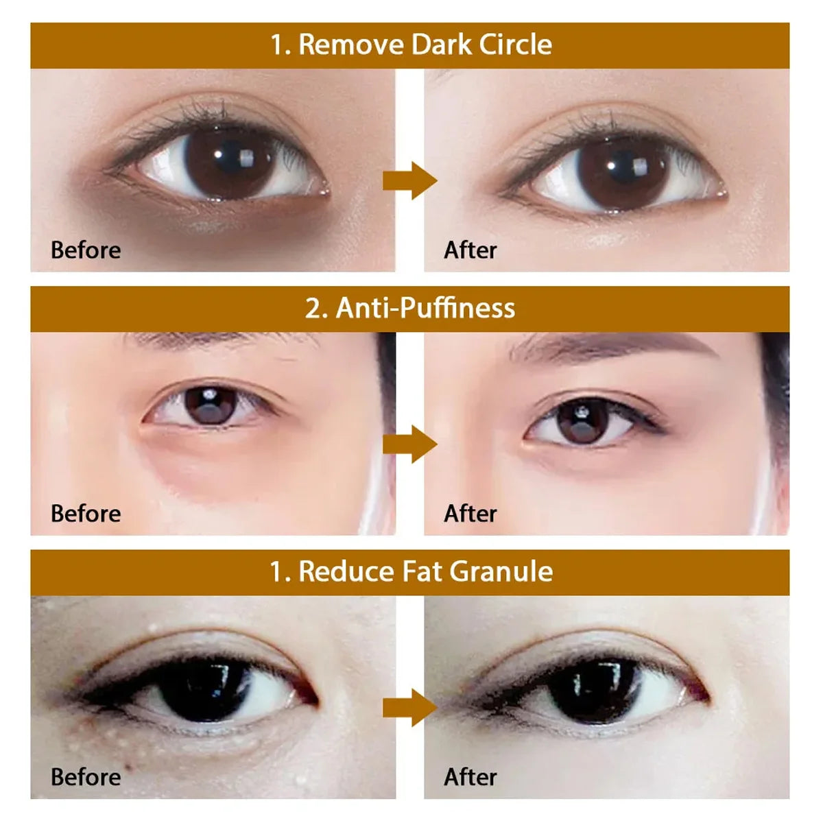 Hyaluronic Acid Eye Mask – 60 Pcs Under Eye Patches for Dark Circles & Puffiness