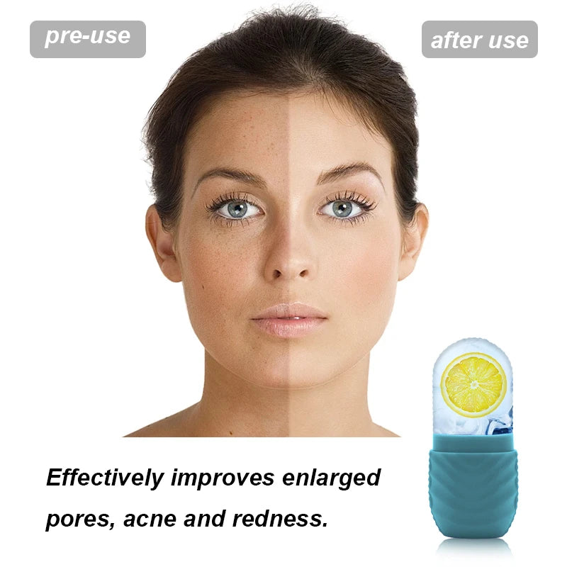 Facial Ice Massage Roller – Silicone Skin Cooling & Beauty Tool