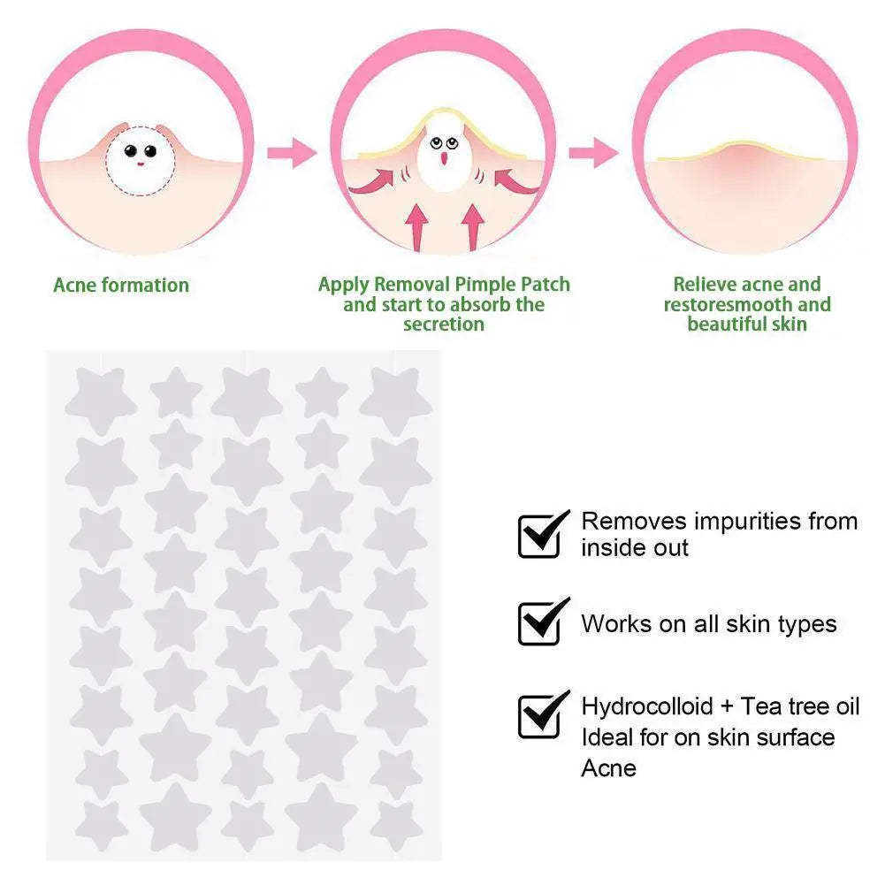 Star Acne Pimple Patches