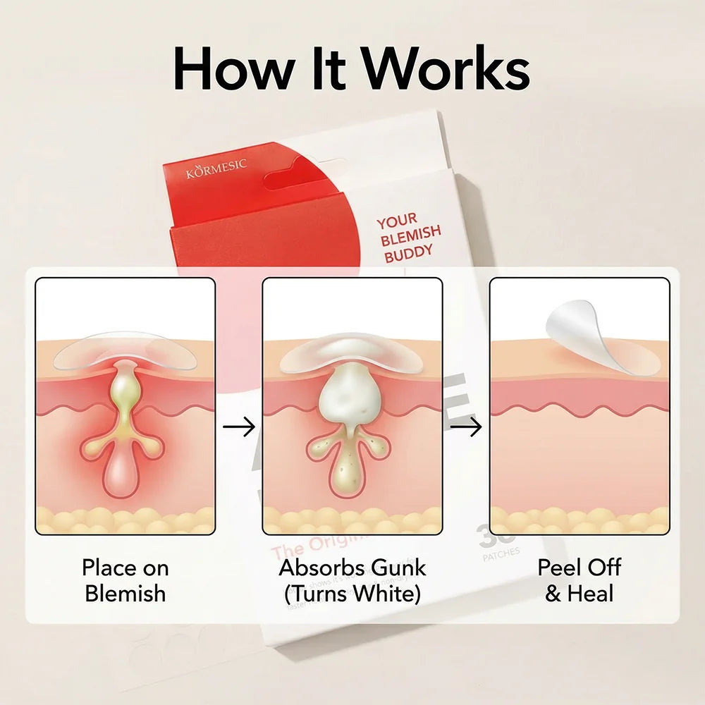 Invisible Acne Pimple Patches (36 Pack)